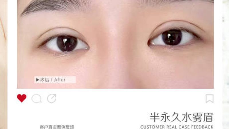皮肤管理项目价格背后的考量因素