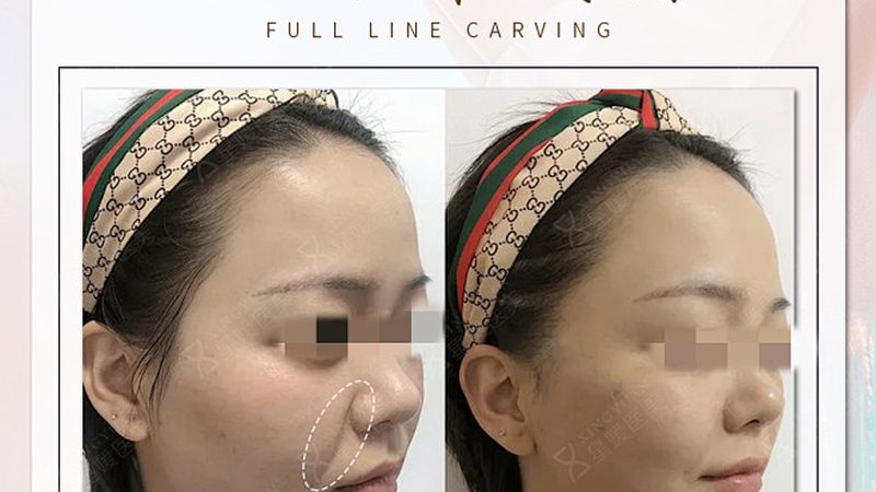 医美咨询师证怎么考？揭秘考取流程与所需学历