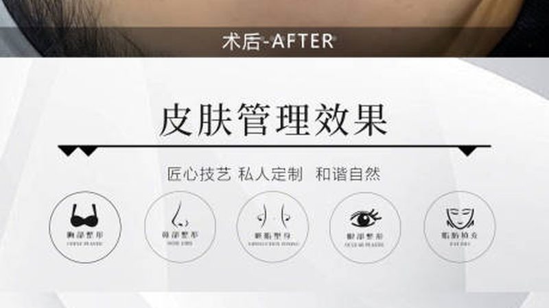 激光祛斑医院排名前十强
