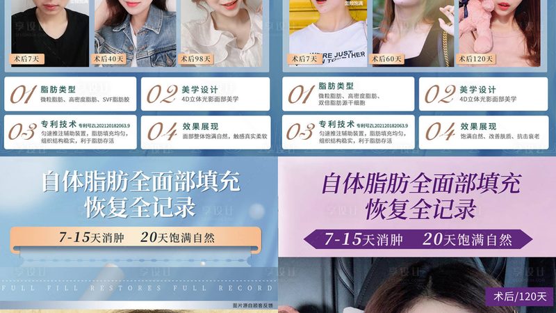 小标题：影响水光针效果维持时间的因素