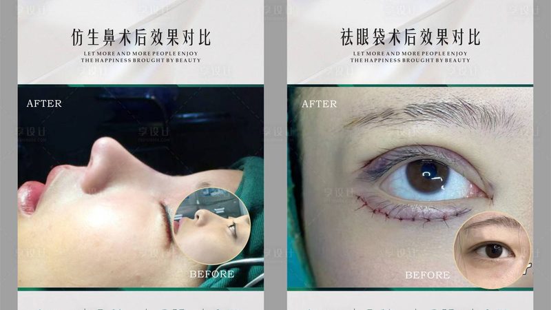 医美咨询师薪资揭秘：工作三个月后的真实情况**