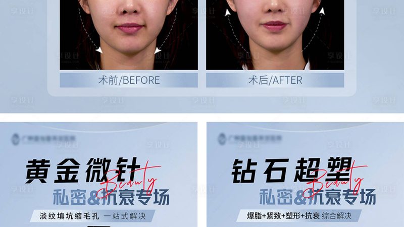 整形美容术后恢复期：揭秘恢复过程中的关键点**