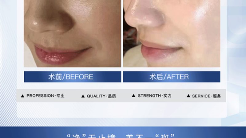 成都医美手术：揭秘手术标准与规范机构