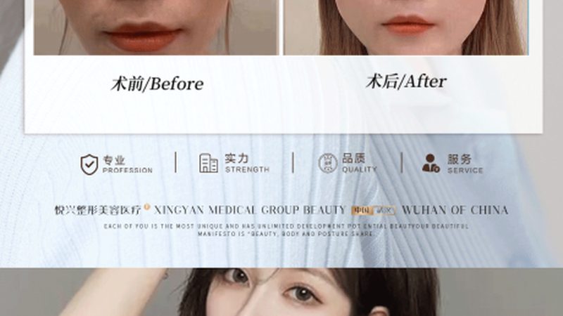 小标题：选择医院，这些因素不能忽视