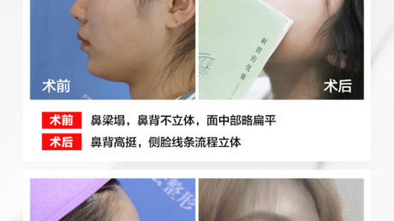 院线产品与美容院合作，揭秘双赢背后的合作模式