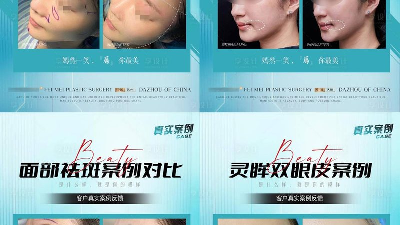 在选择轻医美与生美护理时，应关注以下几点：