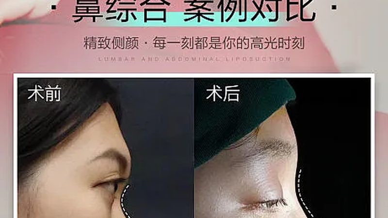 成都皮肤管理厂家直供代理，揭秘优质产品的关键要素