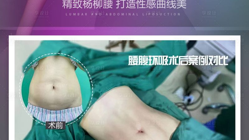 深圳整形医院与美容院仪器差异解析