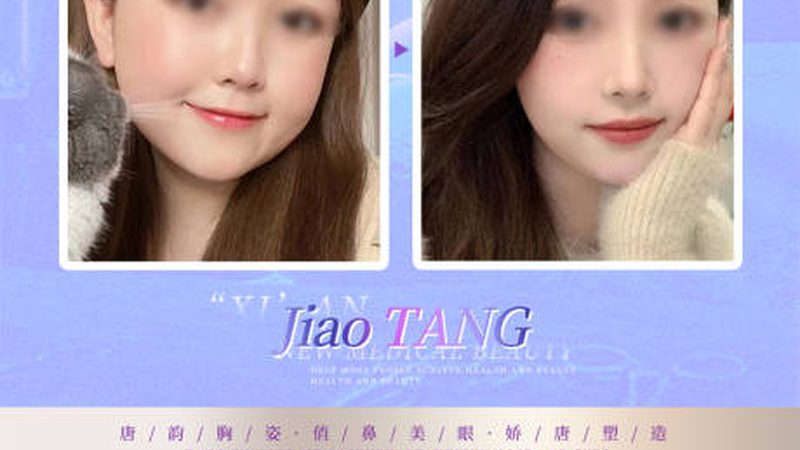 如何辨别热玛吉的真伪：揭秘热玛吉代理的筛选标准